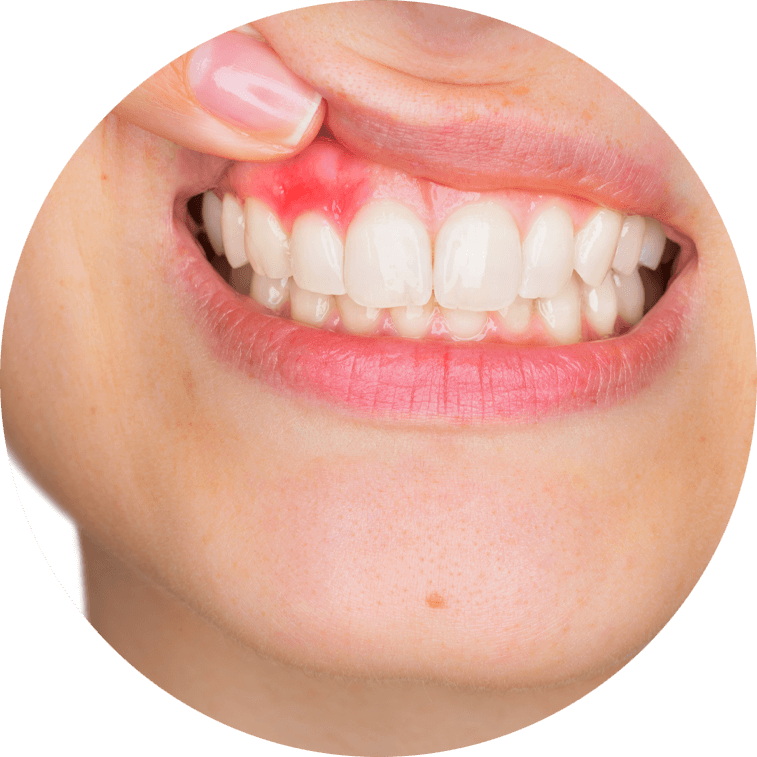 dental patient with gum disease