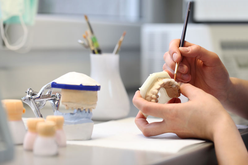 a full mouth dental implant being created in a dental lab