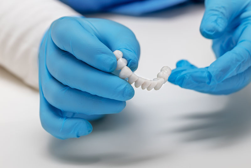 a doctors gloved hands holding a full mouth dental prosthetic for a patients All-On-4 dental implant treatment.
