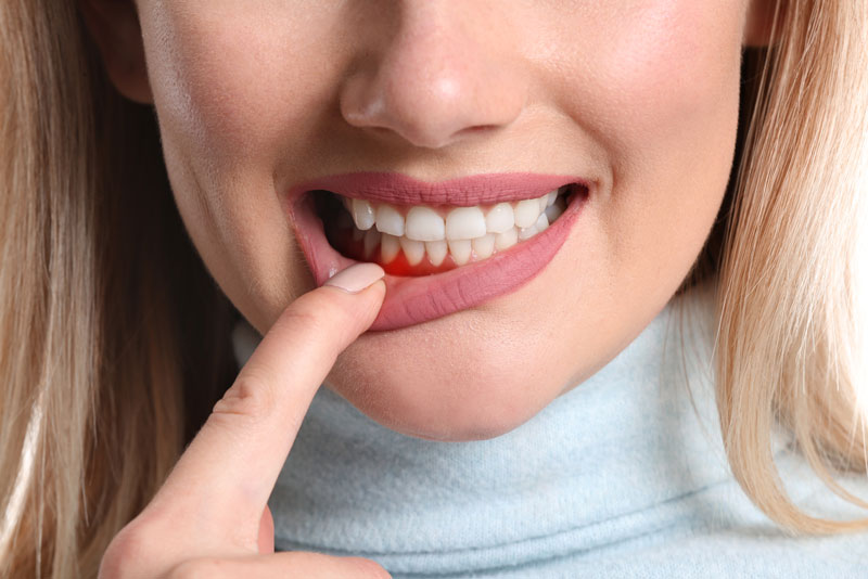 a periodontal patient suffering from gum recession.