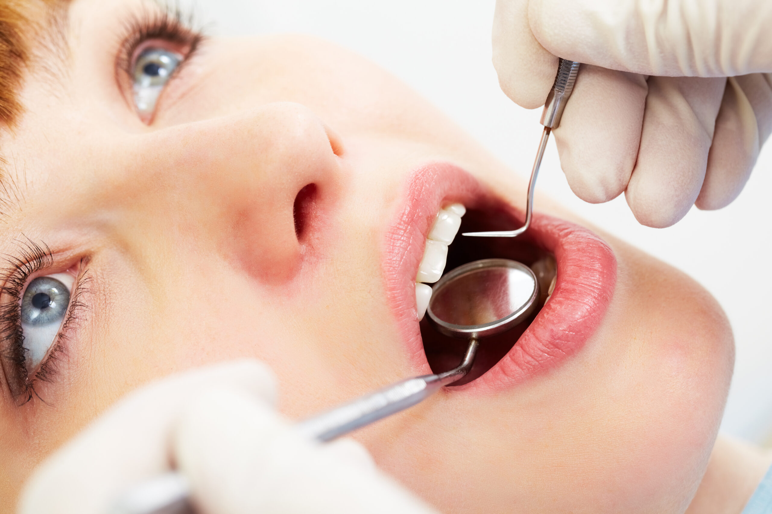 an image of a dental patient getting treated for scaling and root planing procedures.