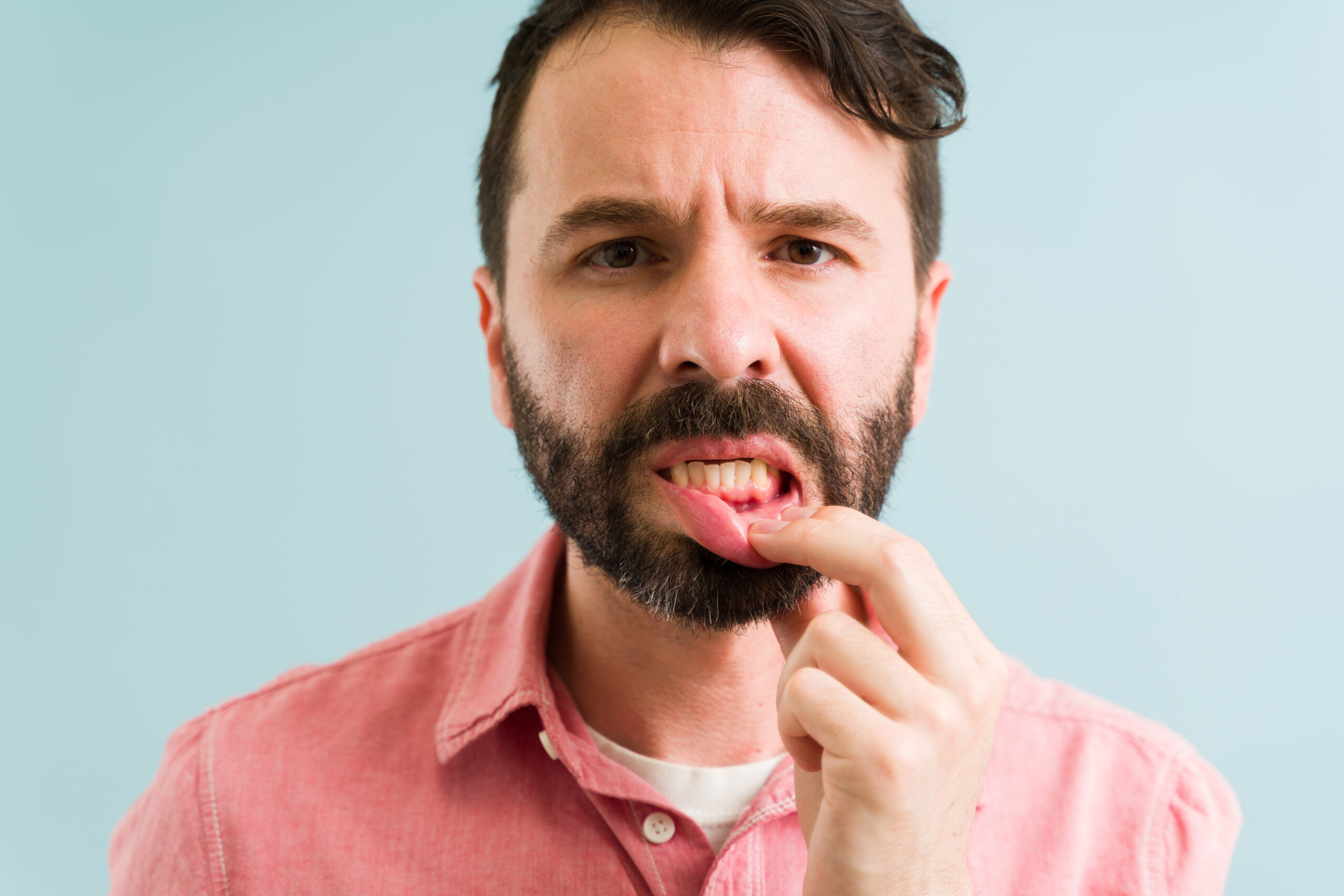 Portrait of an attractive man showing his teeth and making eye contact. Man with gum problems.