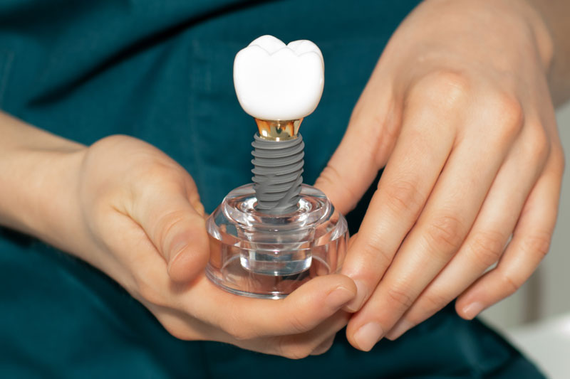a single dental implant model being held up by a doctor